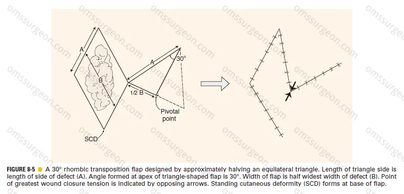 30° rhombic flap