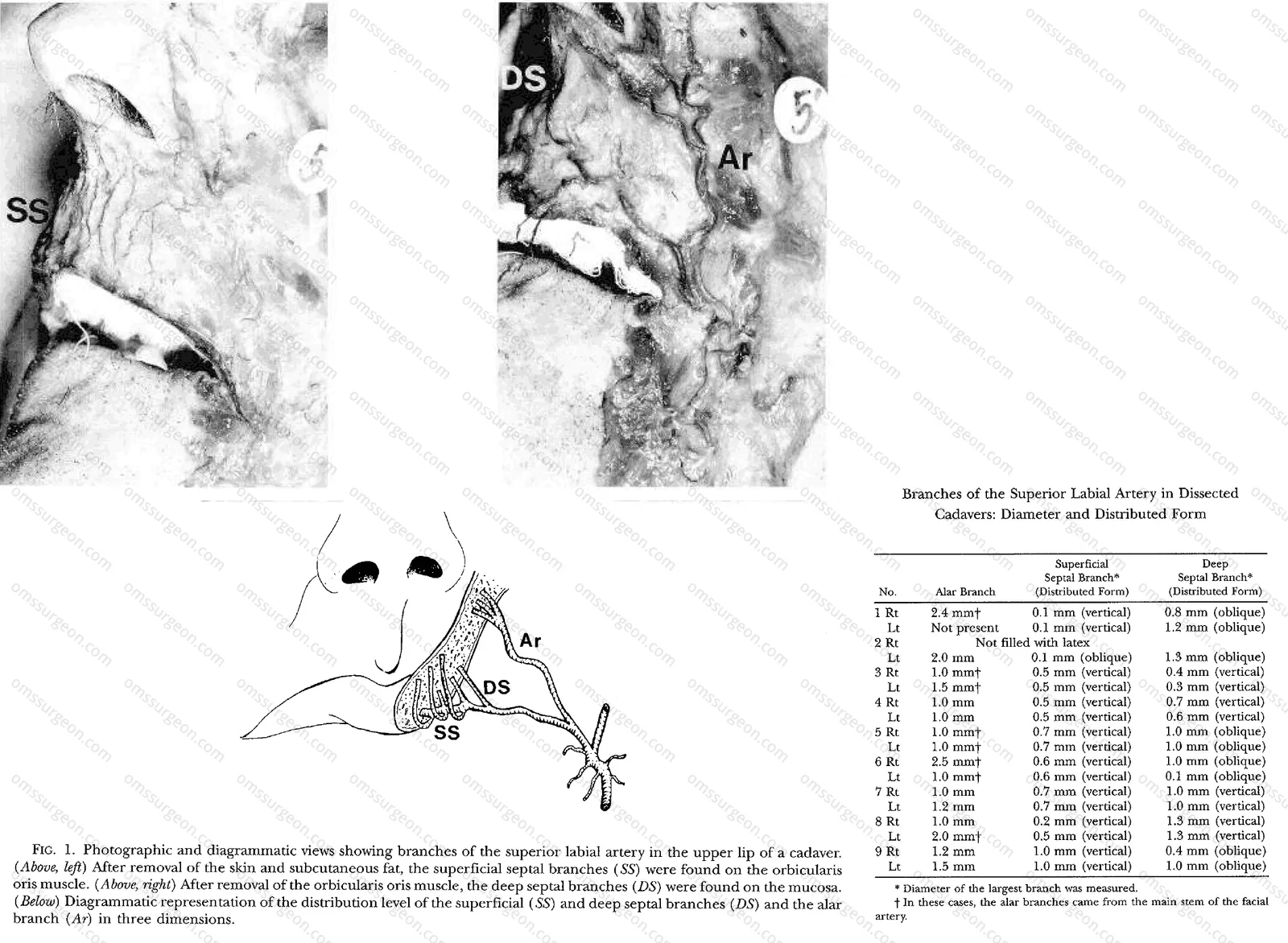 branches-of-the-superior-labial-artery.png