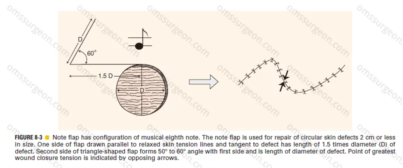 note-flap.png
