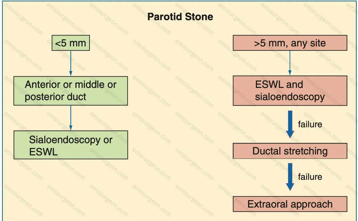 Selecting-parotid-sialoendoscopy-techniques