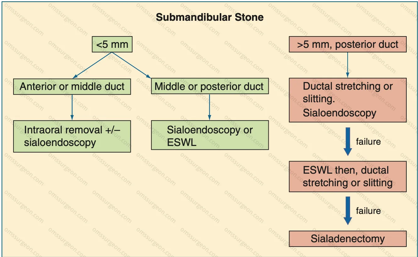Selecting-submandibular-sialoendoscopy-techniques.